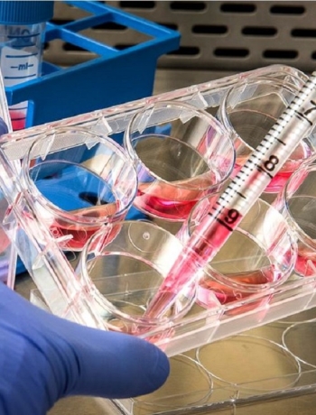 Scoperto un nuovo gene responsabile